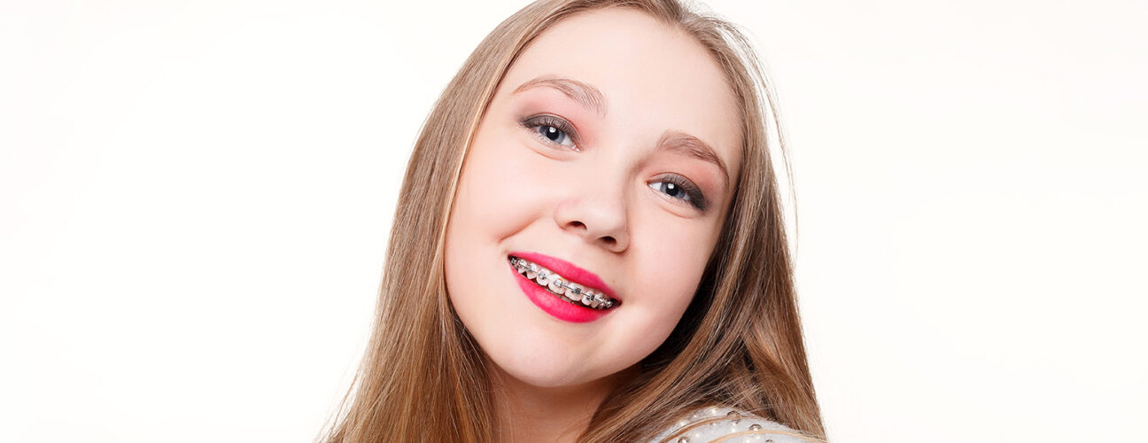 Everything You Should Know about Fastbraces®