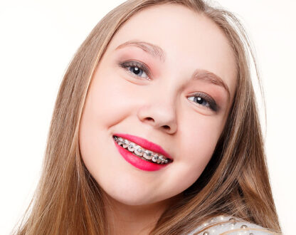 Everything You Should Know about Fastbraces®