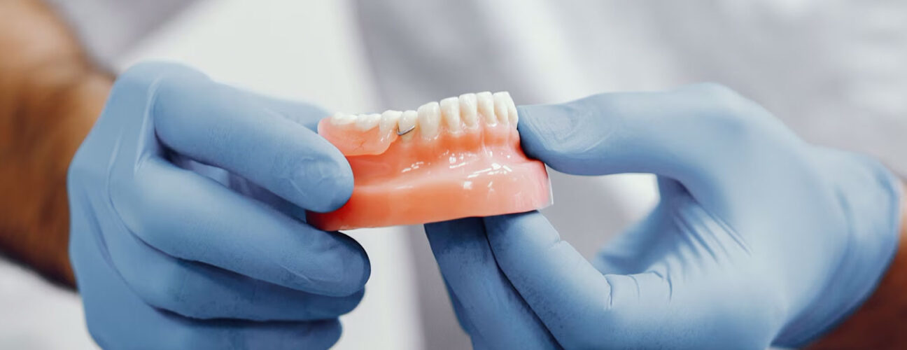 What’s the Dental Bridge Placement Process Like? Step-by-Step Guide