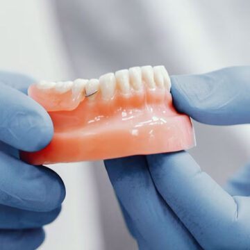 What’s the Dental Bridge Placement Process Like? Step-by-Step Guide