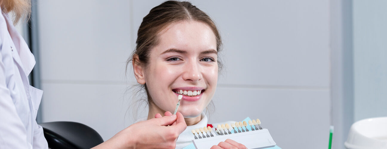 What Facts You Should Know Before Getting Dental Veneers?