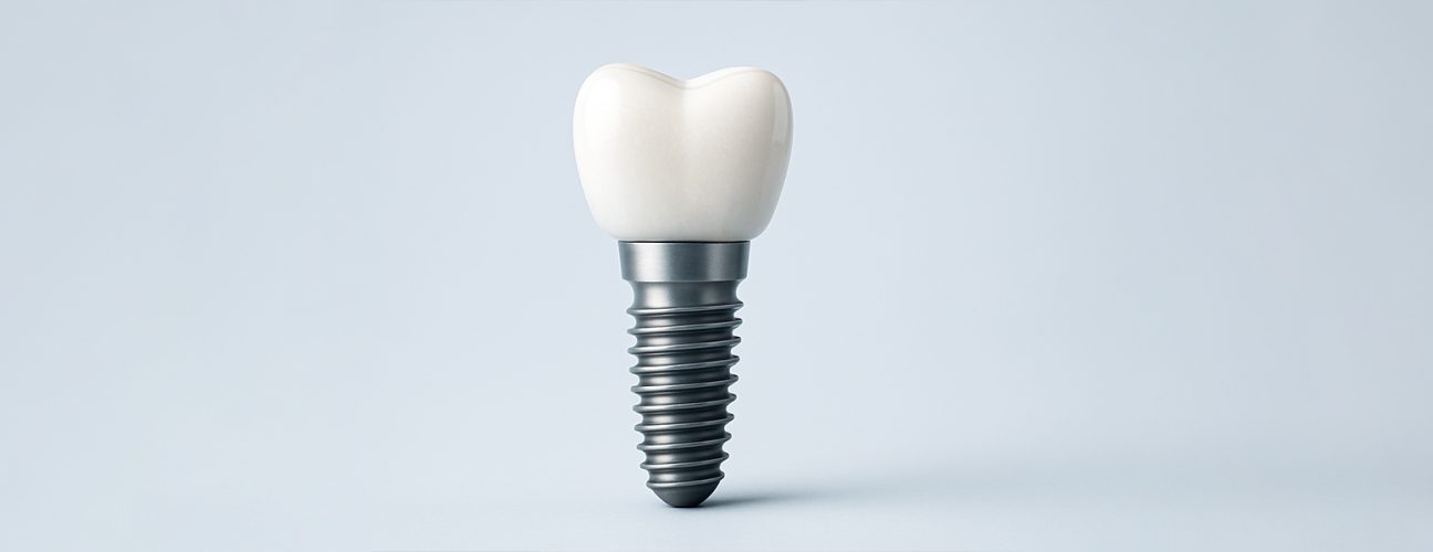 What Should You Expect After Dental Implants in Chicago?
